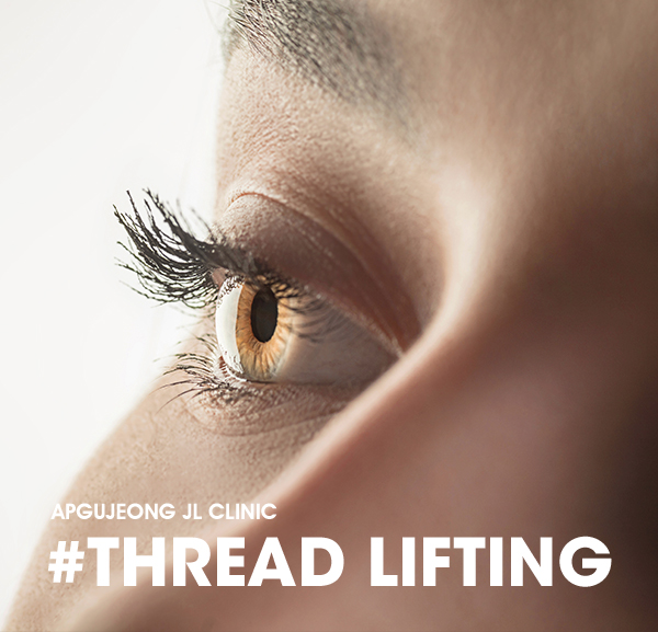 THREAD LIFTING