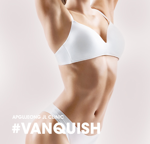 vanquish